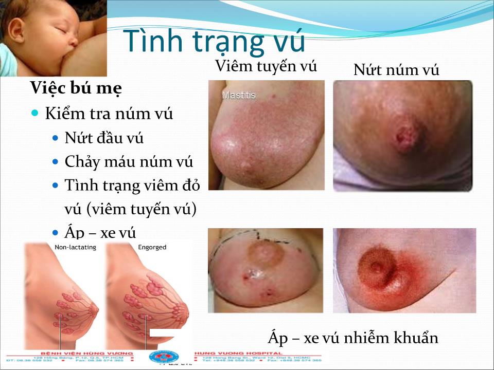 Bài giảng Chăm sóc bà mẹ và trẻ sơ sinh sau xuất viện trang 3