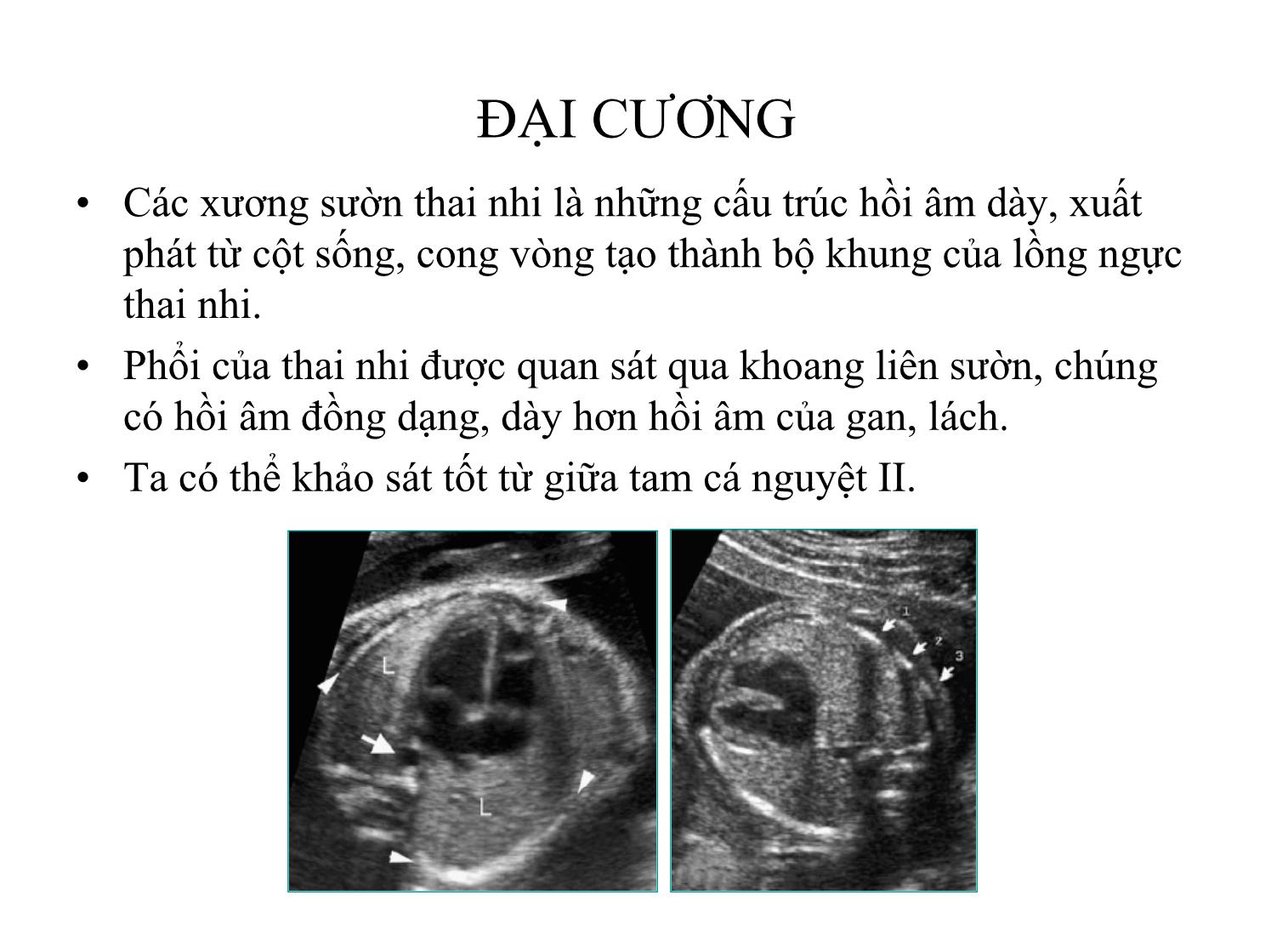 Bài giảng Siêu âm phổi thai nhi trang 3
