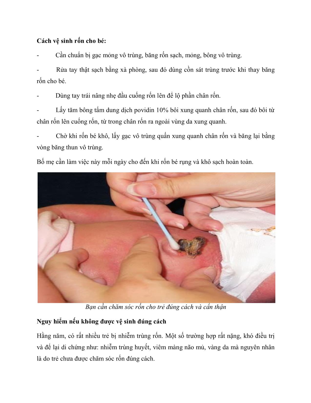 Chăm sóc rốn cho trẻ sơ sinh trang 2
