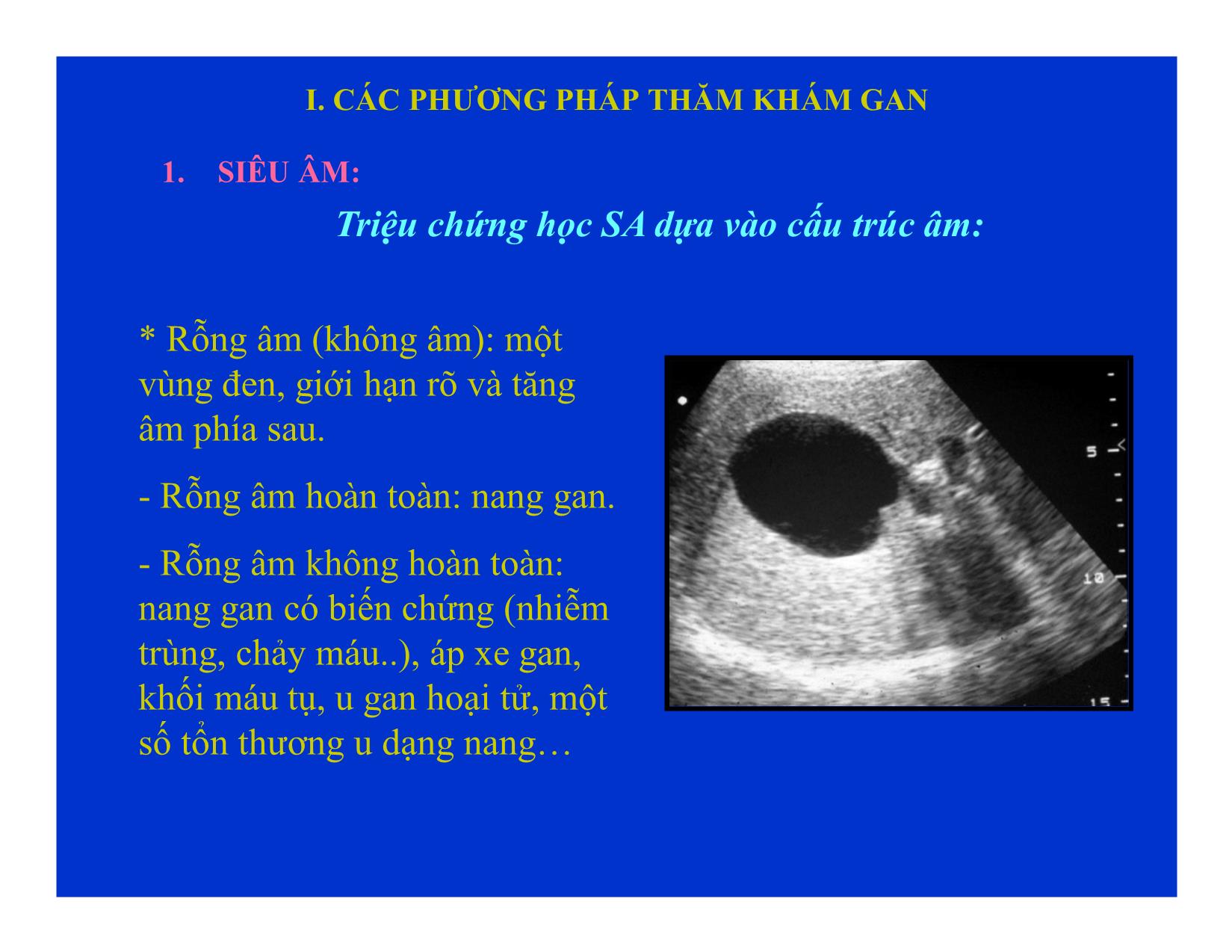 Bài giảng Chẩn đoán hình ảnh gan mật Y4 trang 5