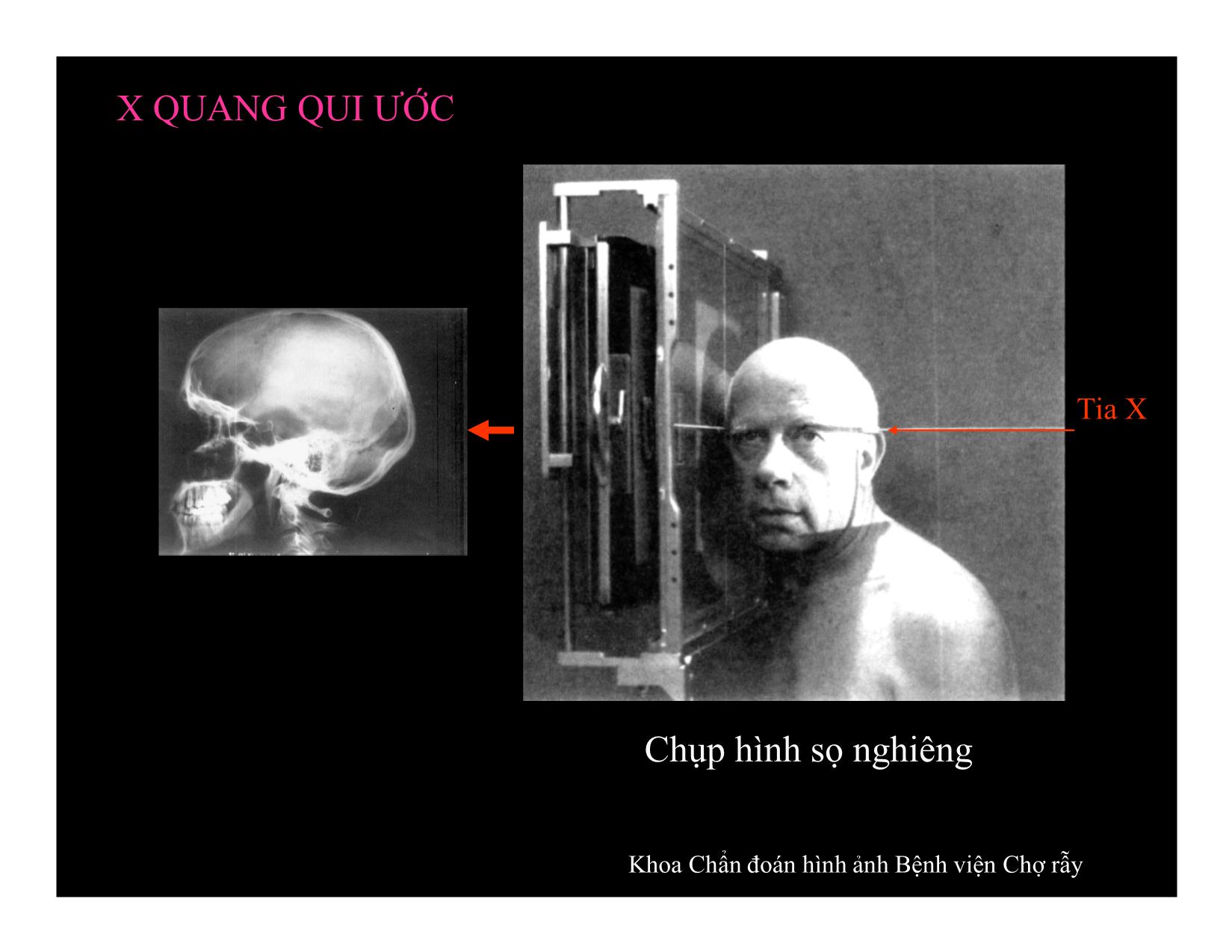 Bài giảng Đại cương CT và đọc phim CT chấn thương sọ não trang 4