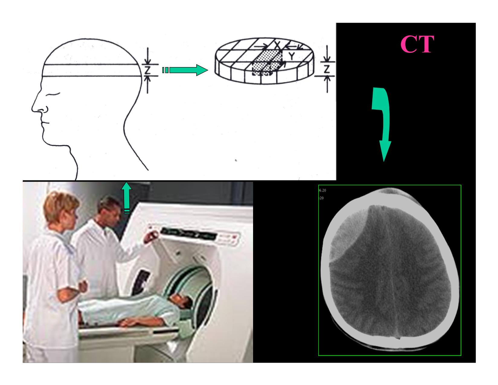 Bài giảng Đại cương CT và đọc phim CT chấn thương sọ não trang 5