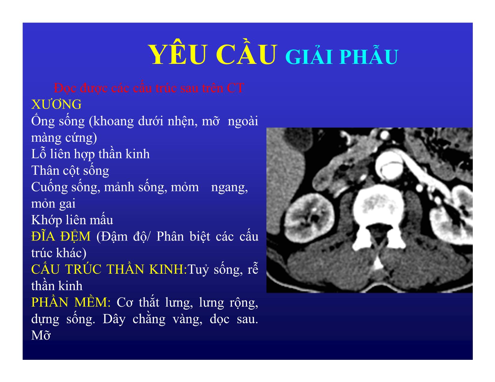 Bài giảng Hình ảnh CT bệnh lý cột sống trang 3