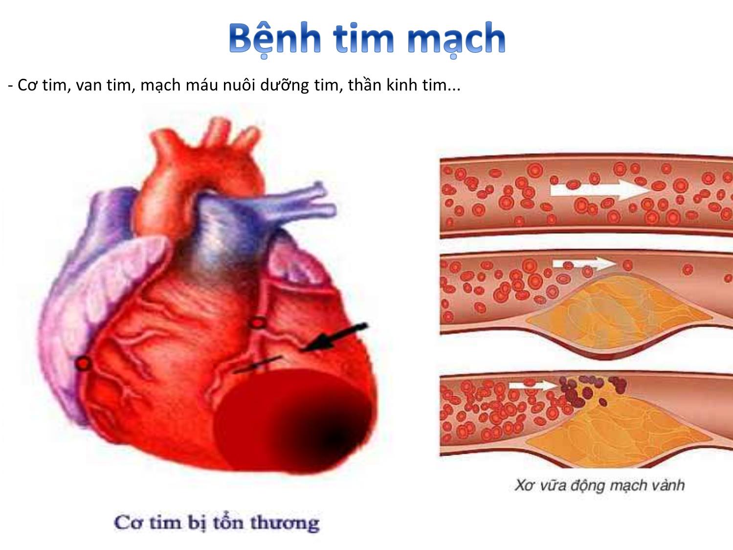 Bài giảng Nghiên cứu và ứng dụng tế bào gốc - Bài 6: Ứng dụng tế bào gốc trong điều trị bệnh tim mạch trang 3