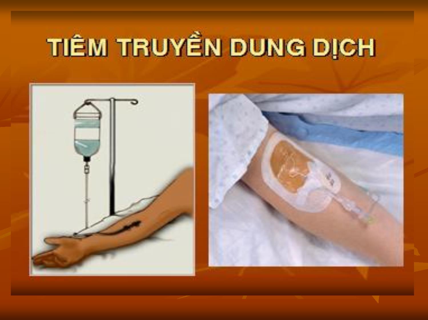 Bài giảng Tiêm truyền dung dịch trang 3