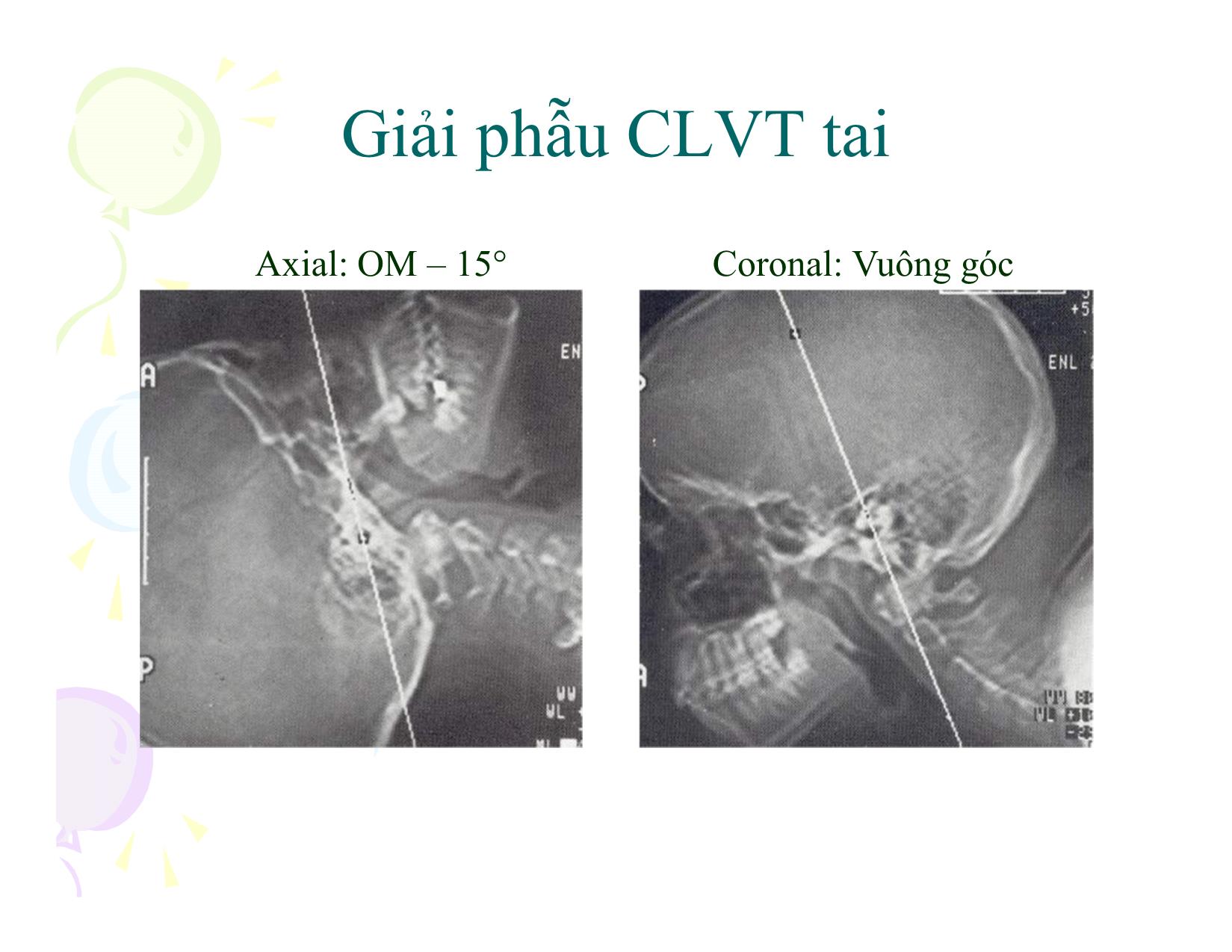 Đề thi Giải phẫu CLVT tai trang 5