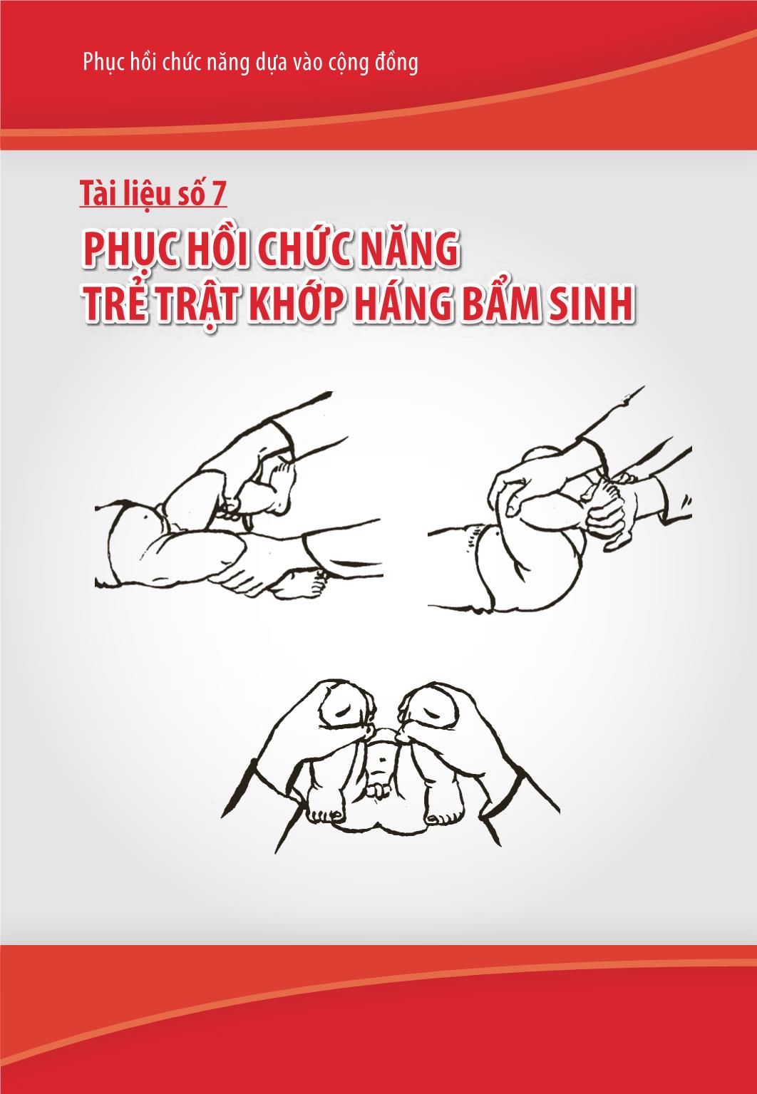 Giáo trình Phục hồi chức năng trẻ trật khớp háng bẩm sinh trang 1