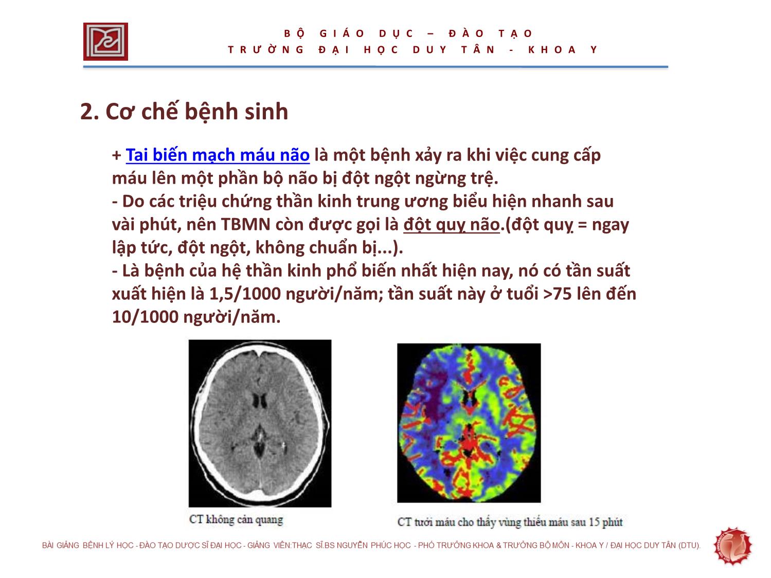 Giáo trình Tai biến mạch não trang 5